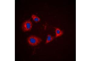 Immunofluorescent analysis of PRKAR1A staining in HT29 cells.