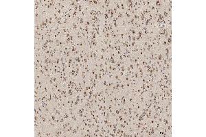 IHC analysis of U1A/SNRPA using anti-U1A/SNRPA antibody (ABIN7600891). (SNRPA1 antibody  (AA 25-218))