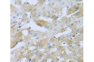 Immunohistochemistry of paraffin-embedded Human liver damage using AP1M2 Polyclonal Antibody at dilution of 1:100 (40x lens). (AP1m2 antibody)