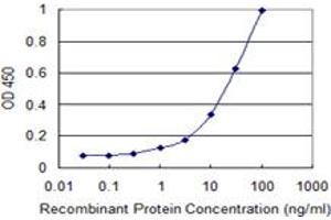 Detection limit for recombinant GST tagged L1CAM is 0. (L1CAM antibody  (AA 23-132))