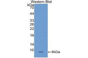 Western Blotting (WB) image for anti-serpin Peptidase Inhibitor, Clade B (Ovalbumin), Member 4 (SERPINB4) (AA 320-390) antibody (ABIN1172467) (SERPINB4 antibody  (AA 320-390))