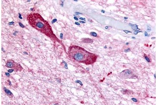 TRHR antibody  (C-Term)