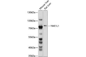 Western blot analysis of extracts of various cell lines, using YME1L1 antibody (ABIN6133153, ABIN6150333, ABIN6150334 and ABIN6214648) at 1:1000 dilution.