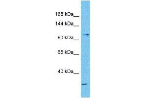 Host:  Rabbit  Target Name:  NFATC3  Sample Type:  Fetal Lung lysates  Antibody Dilution:  1. (NFATC3 antibody  (N-Term))