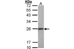 WB Image Sample (30 ug of whole cell lysate) A: Hep G2 , 12% SDS PAGE antibody diluted at 1:1000 (Transgelin antibody)