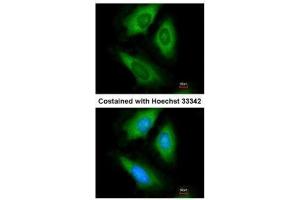 ICC/IF Image Immunofluorescence analysis of paraformaldehyde-fixed HeLa, using HPRT, antibody at 1:200 dilution. (HPRT1 antibody)