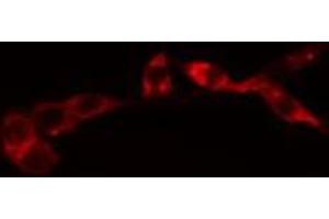 ABIN6274076 staining HeLa cells by IF/ICC. (FADD antibody  (pSer194))