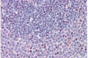 Spleen, Human: Formalin-Fixed, Paraffin-Embedded (FFPE) (NCOA3 antibody  (AA 188-198))