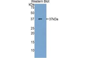 Detection of Recombinant zAP70, Mouse using Polyclonal Antibody to Zeta Chain Associated Protein Kinase 70 kDa (zAP70) (ZAP70 antibody  (AA 270-560))