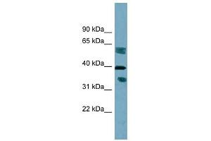 DHRS7B antibody used at 1 ug/ml to detect target protein. (DHRS7B antibody)