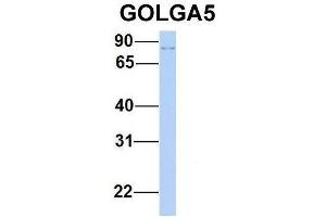 Host:  Rabbit  Target Name:  GOLGA5  Sample Type:  Human 293T  Antibody Dilution:  1. (GOLGA5 antibody  (N-Term))