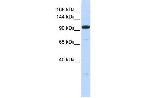 WB Suggested Anti-ZNF228 Antibody Titration:  0. (ZFP112 antibody  (N-Term))