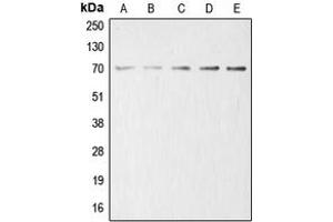 Western blot analysis of Acetylcholinesterase expression in HeLa (A), HEK293T (B), mouse liver (C), rat kidney (D), PC12 (E) whole cell lysates. (Acetylcholinesterase antibody  (Center))