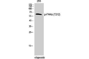 Western Blotting (WB) image for anti-P21-Activated Kinase 1 (PAK1) (pThr212) antibody (ABIN5959788) (PAK1 antibody  (pThr212))
