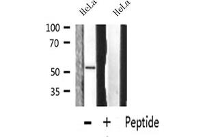 Western blot analysis on HeLa cell lysate using MMP-13 Antibody (MMP13 antibody  (N-Term))