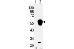 Western Blotting (WB) image for anti-Aldehyde Dehydrogenase 3 Family, Member A1 (ALDH3A1) antibody (ABIN3003526) (ALDH3A1 antibody)