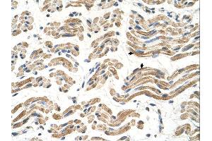 Immunohistochemistry (IHC) image for anti-Aldehyde Dehydrogenase 4 Family, Member A1 (ALDH4A1) (C-Term) antibody (ABIN2782324) (ALDH4A1 antibody  (C-Term))