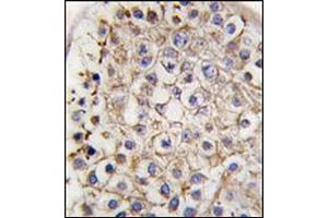 Formalin-Fixed, Paraffin-embedded human testis tissue reacted with Autophagy LC3B Antibody (C-term) followed which was peroxidase-conjugated to the secondary antibody, followed by DAB staining. (LC3B antibody  (C-Term))