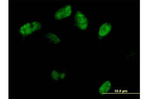 Immunofluorescence of purified MaxPab antibody to SAMHD1 on HeLa cell.