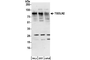 Western Blotting (WB) image for anti-Trans-Golgi Network Protein 2 (TGOLN2) (AA 25-75) antibody (ABIN7455034)