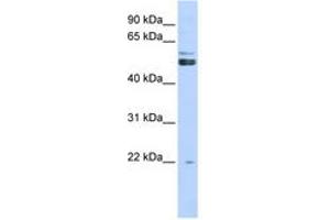Image no. 1 for anti-Protein Arginine Methyltransferase 2 (PRMT2) (AA 71-120) antibody (ABIN6742957) (PRMT2 antibody  (AA 71-120))