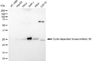 Western blotting analysis using Cyclin dependent kinase inhibitor 1B antibody (ABIN7798223). (Recombinant CDKN1B antibody)