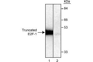 Western Blotting (WB) image for anti-E2F Transcription Factor 1 (E2F1) antibody (ABIN967439) (E2F1 antibody)