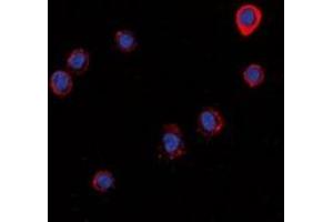 Immunofluorescent analysis of Histamine H1 Receptor staining in LOVO cells. (HRH1 antibody)