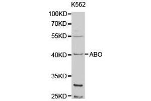 Western Blotting (WB) image for anti-Histo-blood group A transferase (ABO) antibody (ABIN1870743) (ABO antibody)