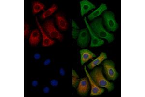 ABIN6263353 and ABIN6272349 staining Hela cells by IF/ICC. (Mrgprf antibody  (C-Term))