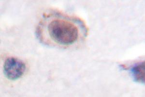 Image no. 2 for anti-Cyclin D1 (CCND1) antibody (ABIN272112) (Cyclin D1 antibody)