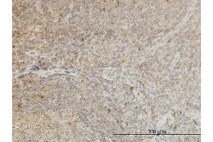 Immunoperoxidase of monoclonal antibody to CDKL4 on formalin-fixed paraffin-embedded human tonsil. (CDKL4 antibody  (AA 196-295))