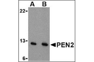 Western blot analysis of PEN2 in A-20 cell lysate with this product at (A) 0.