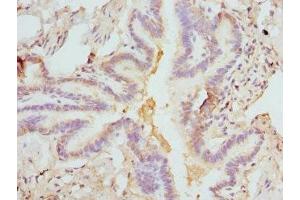 Immunohistochemistry of paraffin-embedded human lung tissue using ABIN7152931 at dilution of 1:100 (FCN1 antibody  (AA 30-326))
