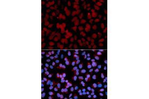 Immunofluorescence analysis of U2OS cells using TNFAIP3 antibody. (TNFAIP3 antibody)