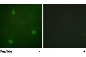 Immunofluorescence analysis of NIH/3T3 cells, using DCLRE1C polyclonal antibody .