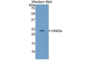 Western blot analysis of the recombinant protein. (RBP4 antibody  (AA 18-201))