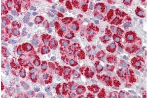 Human Adrenal (formalin-fixed, paraffin-embedded) stained with HSPD1 antibody ABIN462365 followed by biotinylated anti-goat IgG secondary antibody ABIN481715, alkaline phosphatase-streptavidin and chromogen. (HSPD1 antibody)