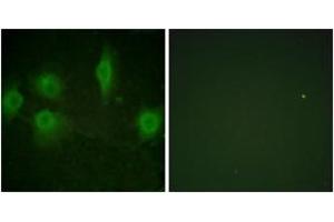Immunofluorescence analysis of HuvEc cells, using IL-9R (Phospho-Ser519) Antibody. (IL9 Receptor antibody  (pSer519))