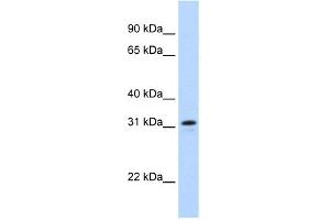 WB Suggested Anti-MKI67IP Antibody Titration:  0. (NIFK antibody  (Middle Region))