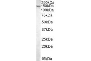 Western Blotting (WB) image for anti-Pyruvate Carboxylase (PC) (Internal Region) antibody (ABIN2466170)