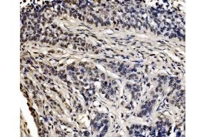 IHC analysis of CPSF6 using anti-CPSF6 antibody (ABIN7601898).