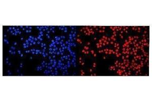 IF analysis of HMGN2 using anti-HMGN2 antibody (ABIN6719576). (HMGN2 antibody)