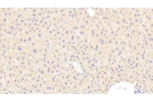 Immunohistochemistry (IHC) image for anti-Serpin Peptidase Inhibitor, Clade G (C1 Inhibitor), Member 1 (SERPING1) (AA 35-179) antibody (ABIN7438466)