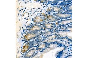 Immunohistochemistry analysis of paraffin embedded mouse small intestine using CA13 (ABIN7073310) at dilution of 1: 400 (CA13 antibody)