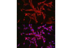 Immunofluorescence analysis of PC-12 cells using CTNN Rabbit pAb (ABIN7266134) at dilution of 1:100 (40x lens).