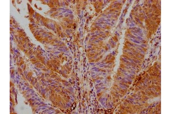 AKTIP antibody  (AA 1-292)