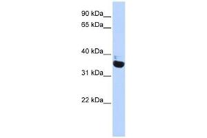 OR13C5 antibody used at 1 ug/ml to detect target protein. (OR13C5 antibody  (N-Term))