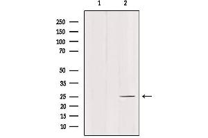 Western blot analysis of extracts from mouse brain, using C1QL4 Antibody.