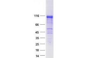 Validation with Western Blot (RIN2 Protein (Myc-DYKDDDDK Tag))